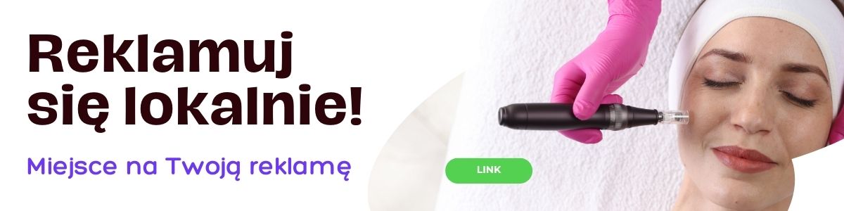 Reklamuj się lokalnie w Szczecinie – Szczecin Portal